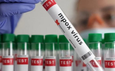 WHO Supports Ghana with Mpox Testing Kits to Boost Diagnostic Capacity